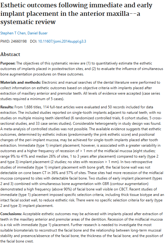임플란트 식립 시뮬레이션